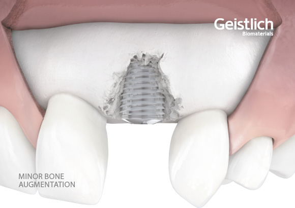 min-bone1_geistlich