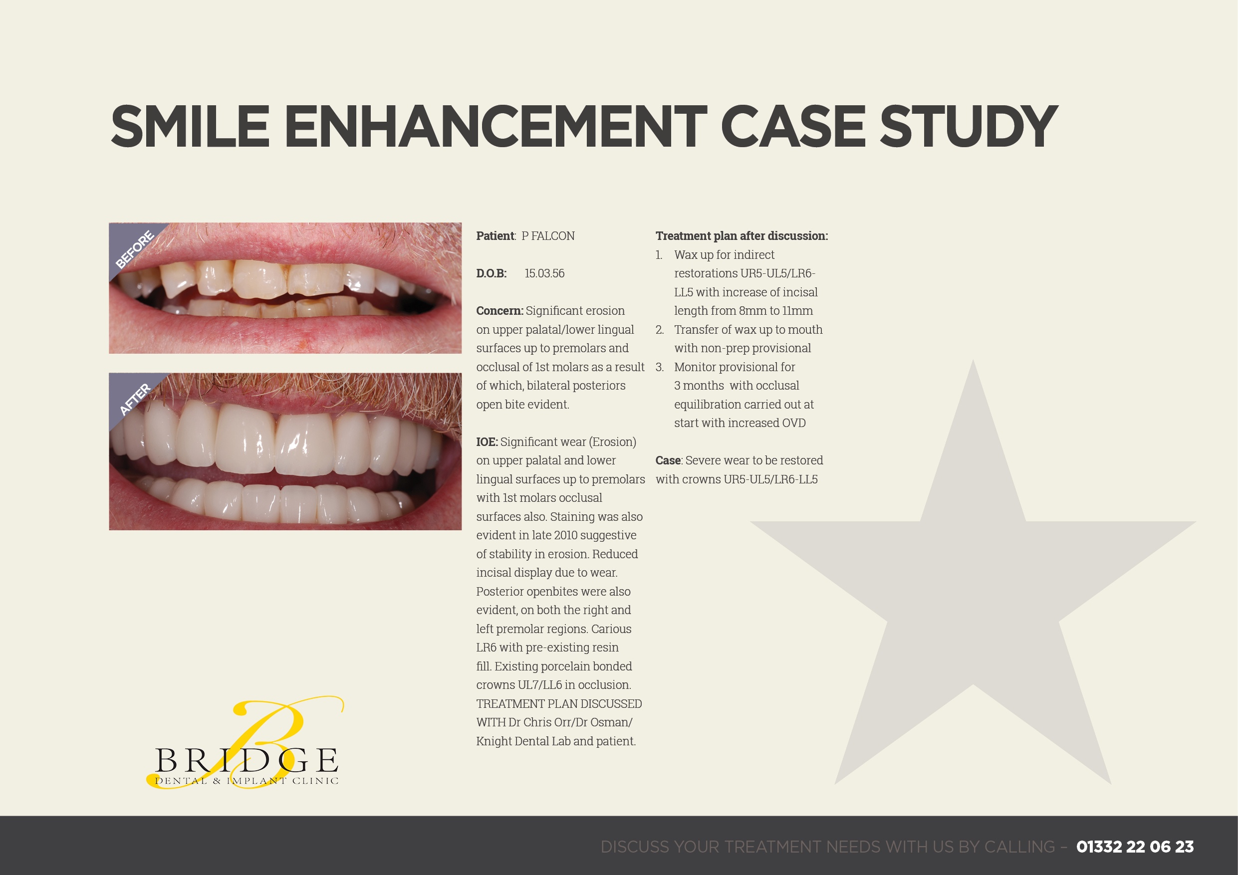 Smile enhancement Case Study - Bridge Dental Clinic