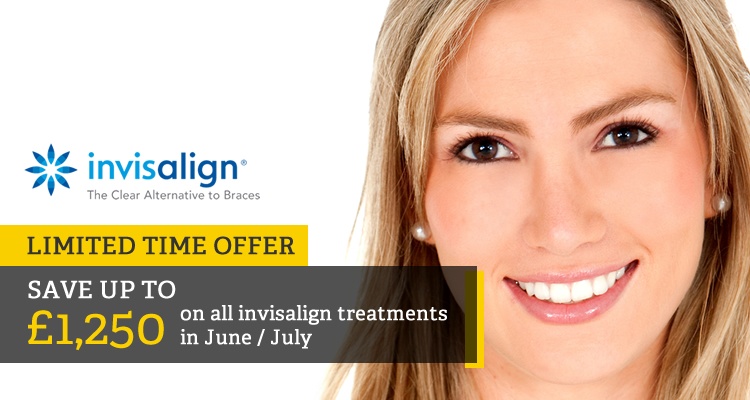 bridge-invisalign-offer-blog