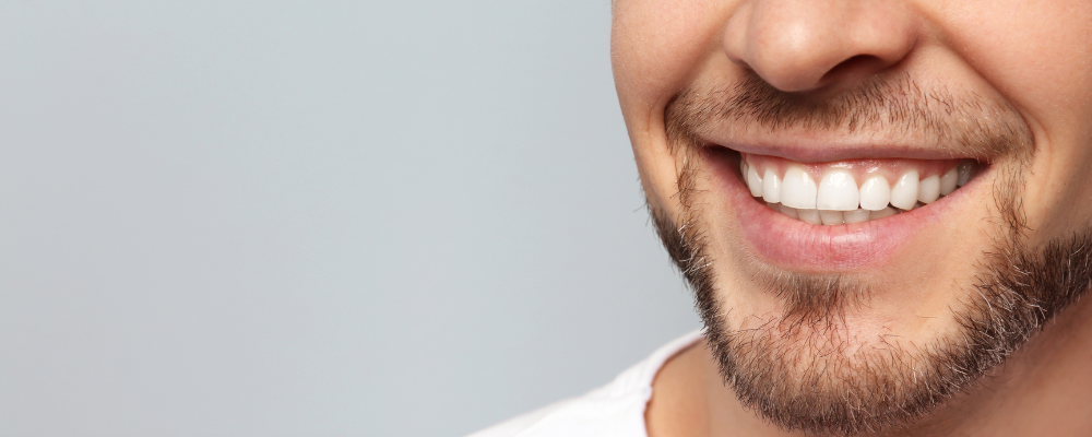 close up of a man's teeth after whitening