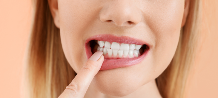 Blonde woman showing teeth and pointing at bottom canine