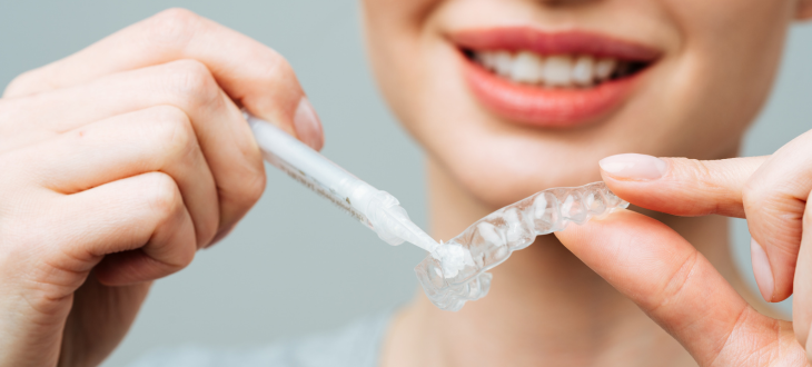 woman putting whitening gel into aligners, an example of cosmetic dentistry
