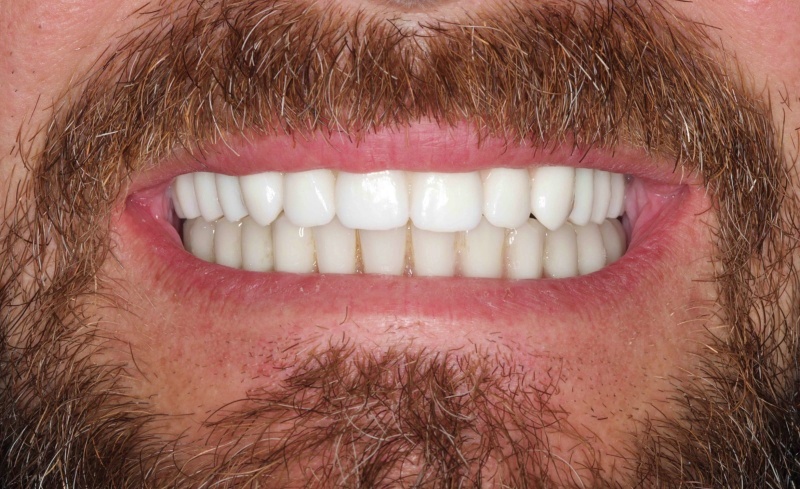 After -Bridge Dental