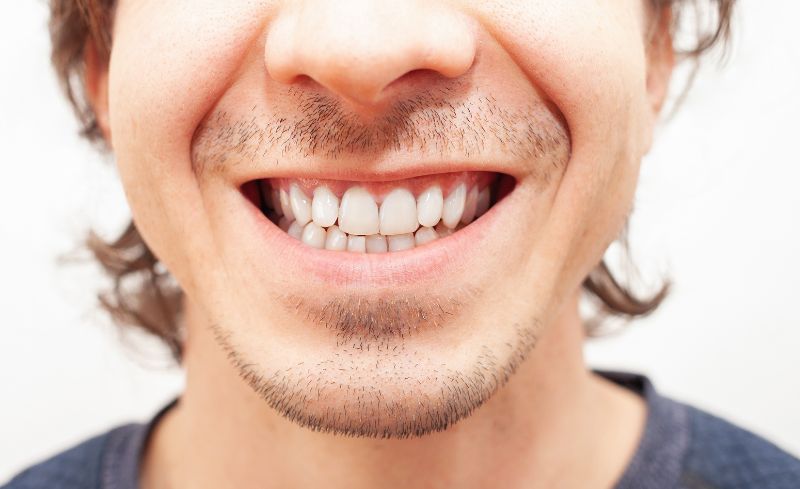 After -Bridge Dental