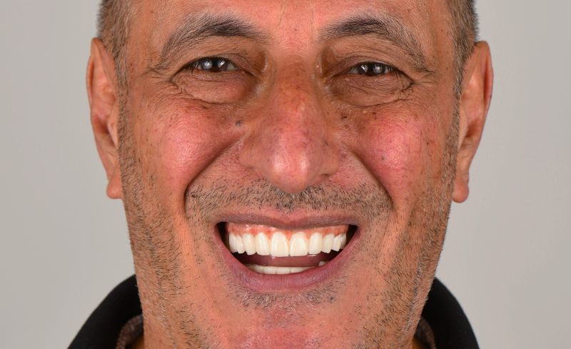 After -Bridge Dental