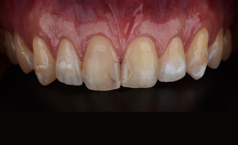 Before - Bridge Dental