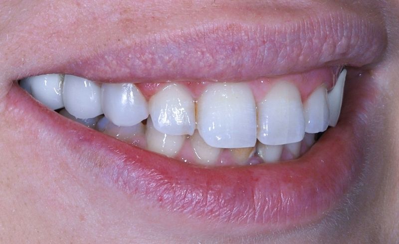 After -Bridge Dental