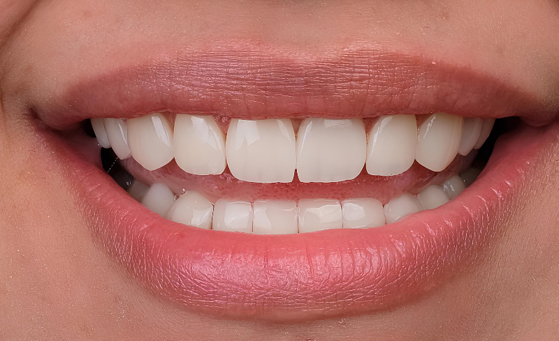 After -Bridge Dental